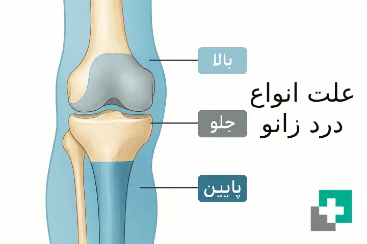 علت انواع درد زانو
