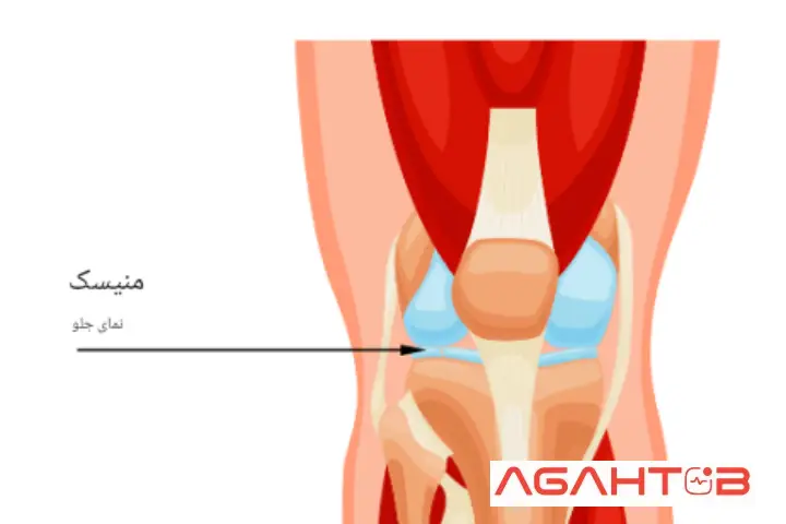 مینیسک داخلی و خارجی