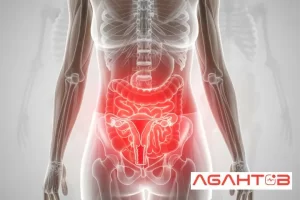 علت درد کمر سمت چپ بالای لگن در زنان