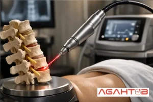 لیزر درمانی تنگی کانال نخاعی آگاه طب